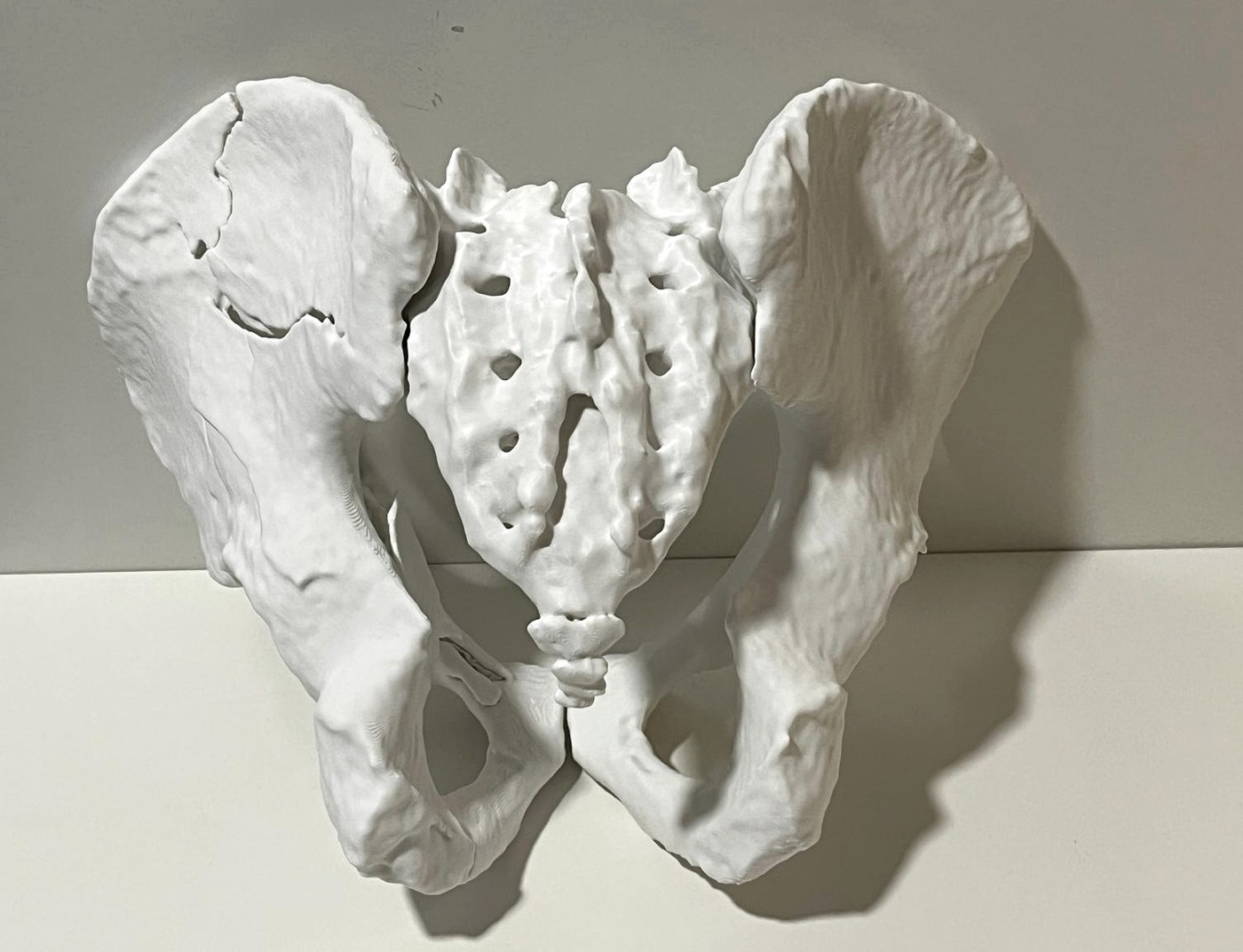 Modelo de pelvis impreso en 3D a tamaño real